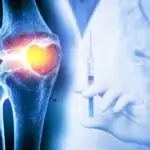 Regenerative medicine therapy used to support healing of damaged tissues and joints