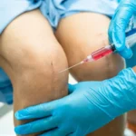 Prolozone therapy injection used for joint and tissue pain relief and regeneration