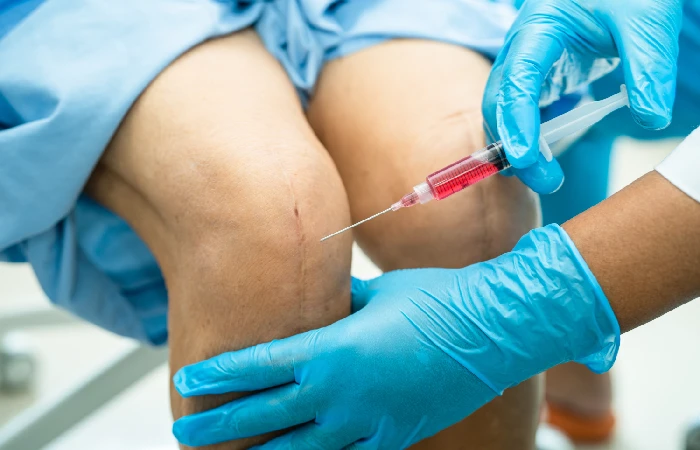 Prolozone therapy injection used for joint and tissue pain relief and regeneration