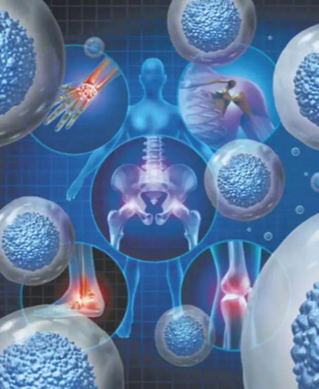 Regenerative medicine therapy used to support healing of damaged tissues and joints